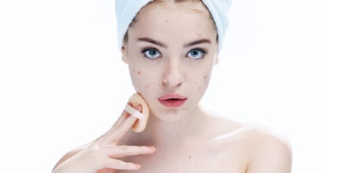 Jangan Khawatir, Begini Cara Pakai Makeup saat Kulit Berjerawat