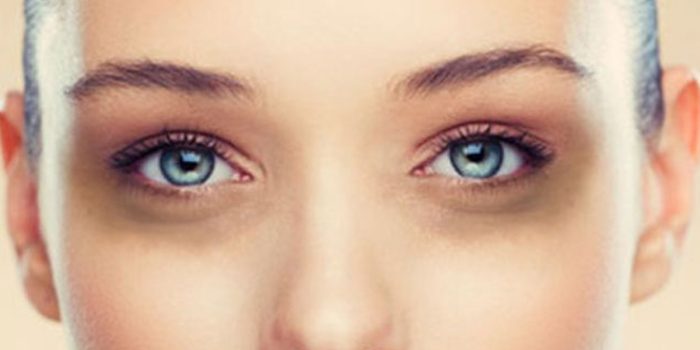 3 Tips Alami Menghilangkan Lingkaran Hitam Dimata